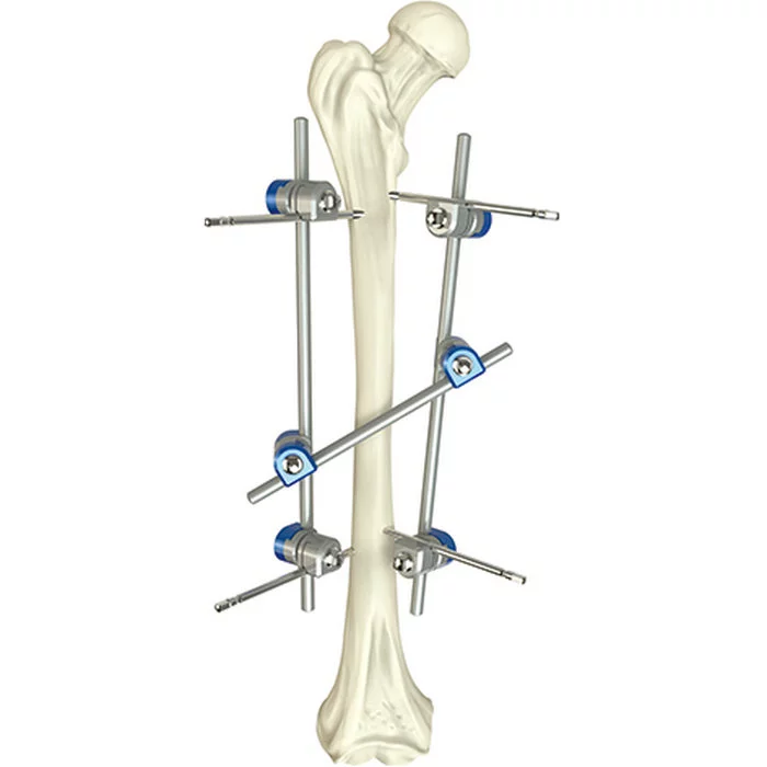 Qualität versicherte grundlegende orthopädische chirurgisches Instrument-Schenkelwelle externen medizinischen chirurgischen medizinischen Instrumenten Fixator