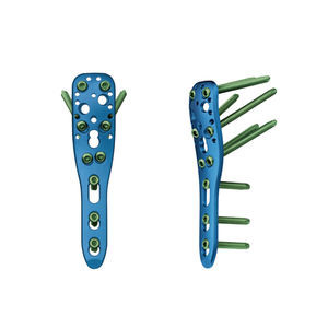 Orthopädische kleine Fragment-Trauma-Sicherungsblech-Schraube