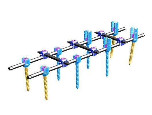 Orthopädie-spinale interne Fixierungs-Ⅳspinales Fixierungs-System