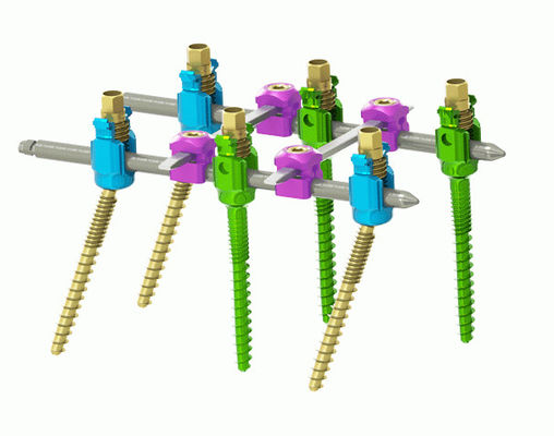 Minimal eingreifendes internes spinales Fixierungs-System
