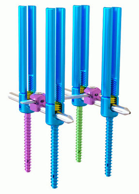 Interne spinale Fixierungs-System-ArtⅠ minimal Invasions