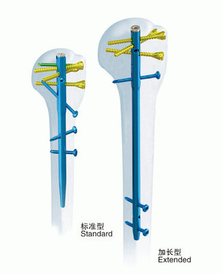 Chirurgischer Orthopädie-anatomischer Humerus-Ineinander greifennagel