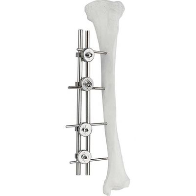Orthopädisches Implantats-Schenkelbein Tibial externe Fixator-Knochen-Chirurgie Fixator
