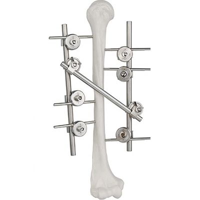Humeral externes Fixierungs-Gerät-orthopädisches chirurgisches Titanimplantat