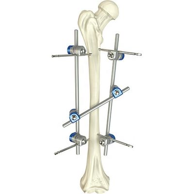Grundlegendes orthopädisches Instrument stellte chirurgische Schenkelwellen-externes Fixierungs-Gerät ein