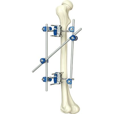Ausgezeichnetes Qualitäts-Instrument-orthopädisches Schienbein u. externe Fixator orthopädische chirurgische Instrumente Percone