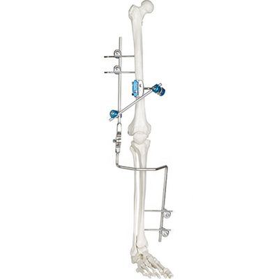 Medizinisches Kniegelenk-externe Fixierungs-Gerät-orthopädische chirurgische Instrumente
