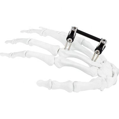 Orthopädisches chirurgisches Mini Fragment Ilizarov External Fixations-Gerät