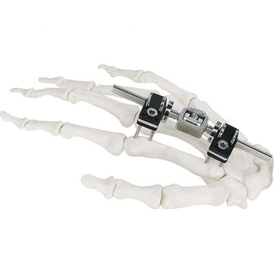 Orthopädisches chirurgisches Mini Fragment Ilizarov External Fixations-Gerät