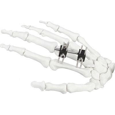 Orthopädisches chirurgisches Mini Fragment Ilizarov External Fixations-Gerät