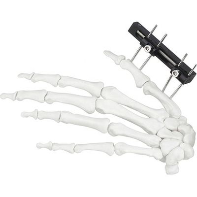 Orthopädisches chirurgisches Mini Fragment Ilizarov External Fixations-Gerät