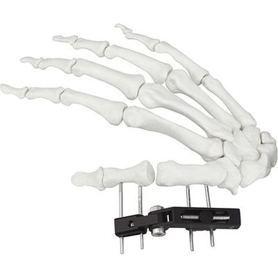 Orthopädisches chirurgisches Mini Fragment Ilizarov External Fixations-Gerät