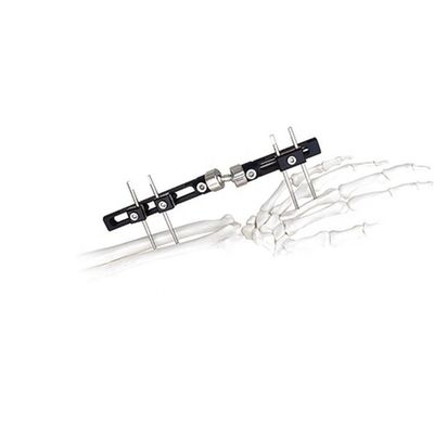 Orthopädisches chirurgisches externes Fixierungs-Gerät-Handgelenk