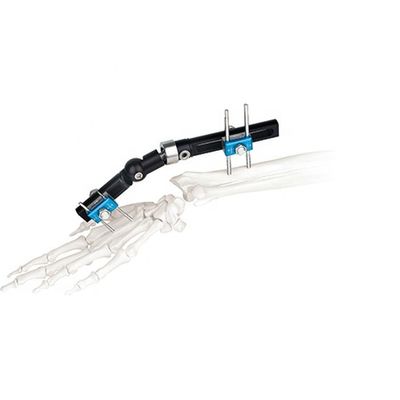 Orthopädisches chirurgisches externes Fixierungs-Gerät-Handgelenk