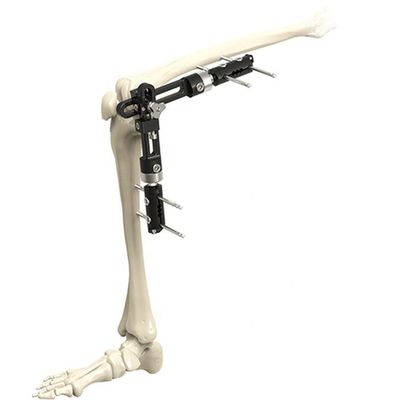 Orthopädisches chirurgische Instrument-Kniegelenk der hohen Qualität externe externe Fixierung orthopädisches chirurgisches Instrumen Fixator