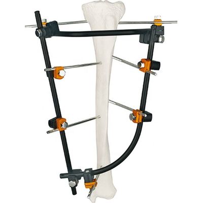 Ausgezeichnete Qualitäts-orthopädische chirurgische Instrumente externe Fixator-Instrument-Satz--IIIinstrument-medizinischer Titansatz