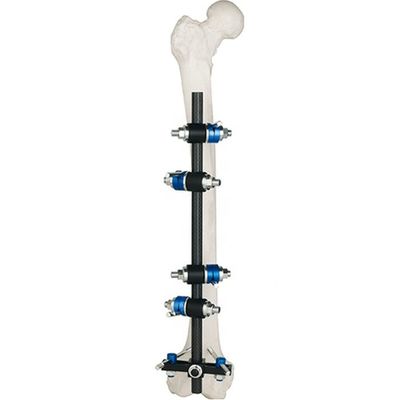 Condylar externes Fixierungs-Gerät