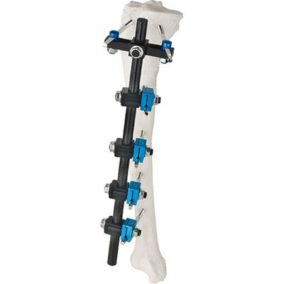 Condylar externes Fixierungs-Gerät
