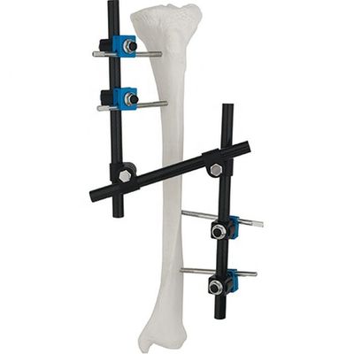 Condylar externes Fixierungs-Gerät