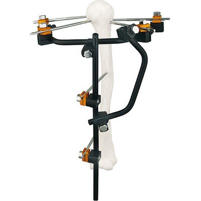 Condylar externes Fixierungs-Gerät