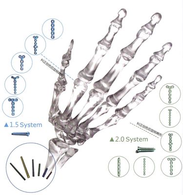 Orthopädisches Implantats-Knochen-Bruch-Titansicherungsblech für Handfuß