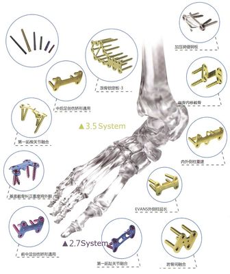 Orthopädisches Implantats-Knochen-Bruch-Titansicherungsblech für Handfuß