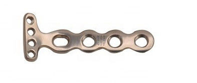 Medizinischer seitlicher Volar Sicherungsblech-distaler Radius-orthopädisches Chirurgie-Instrument