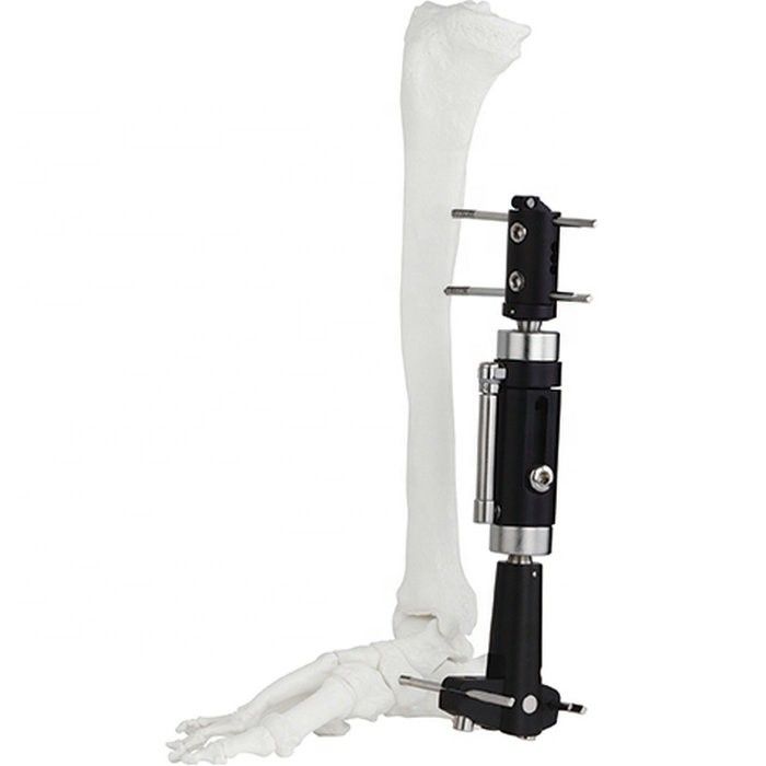 Sicherlich Qualitäts-orthopädisches chirurgische Instrument-Knöchel-Gelenk-Fragment externe externe Fixierung chirurgisches Instrum Fixator
