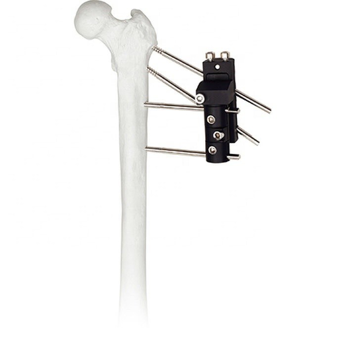 Bild-Video-iconimagebild der Ansicht fügen größeres konkurrenzfähiger Preis-orthopädischem chirurgische Instrument-Hüftgelenk CompareShare hinzu