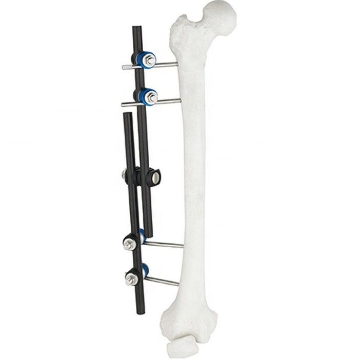 Heißer Verkaufs-orthopädische chirurgische Instrumente Tibial u. Schenkelbein externe externe Fixierungs-orthopädisches Instrument Fixator AO